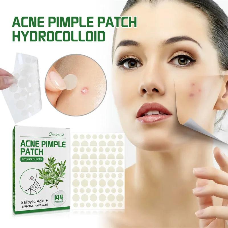Overnight Acne Care Patches with Salicylic Acid and Tea Tree Oil  ourlum.com   