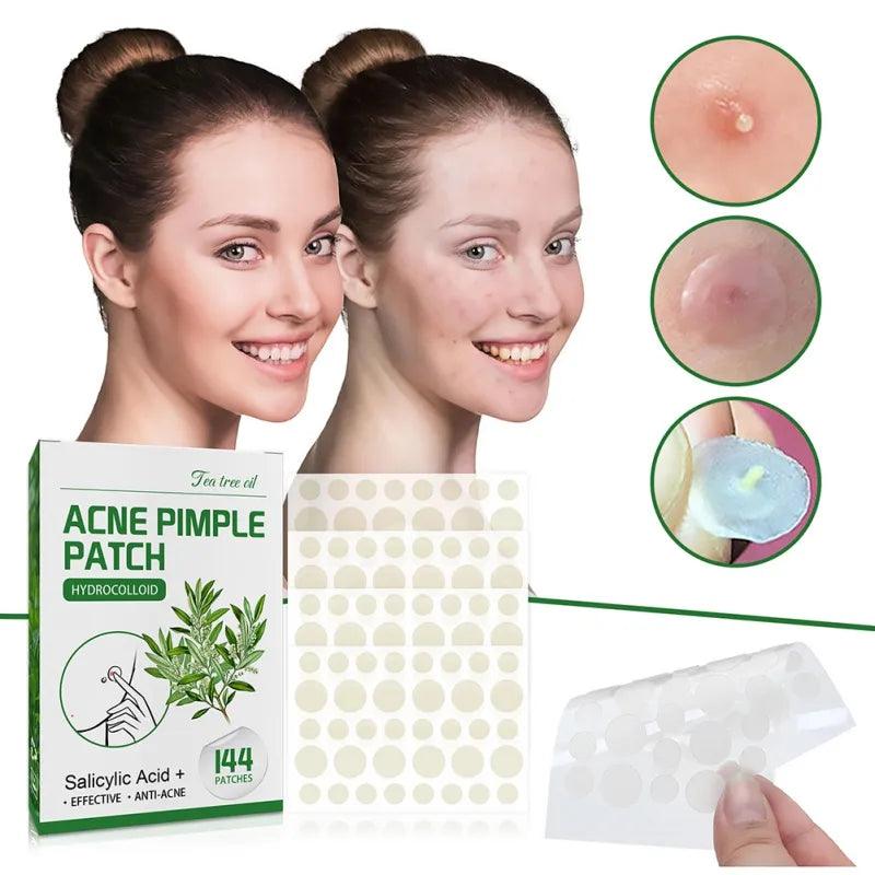 Overnight Acne Care Patches with Salicylic Acid and Tea Tree Oil  ourlum.com   
