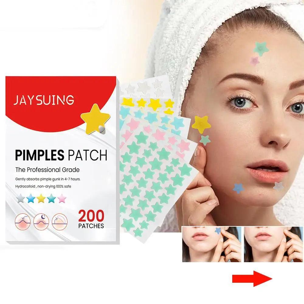 Clear Complexion Star Acne Healing Stickers - 200pcs Colorful Pimple Patches for Blemish-Free Skin  ourlum.com   