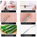 Clear Skin Solution: Professional Acne Removal Tool Set for Blackheads and Pimples  ourlum.com   