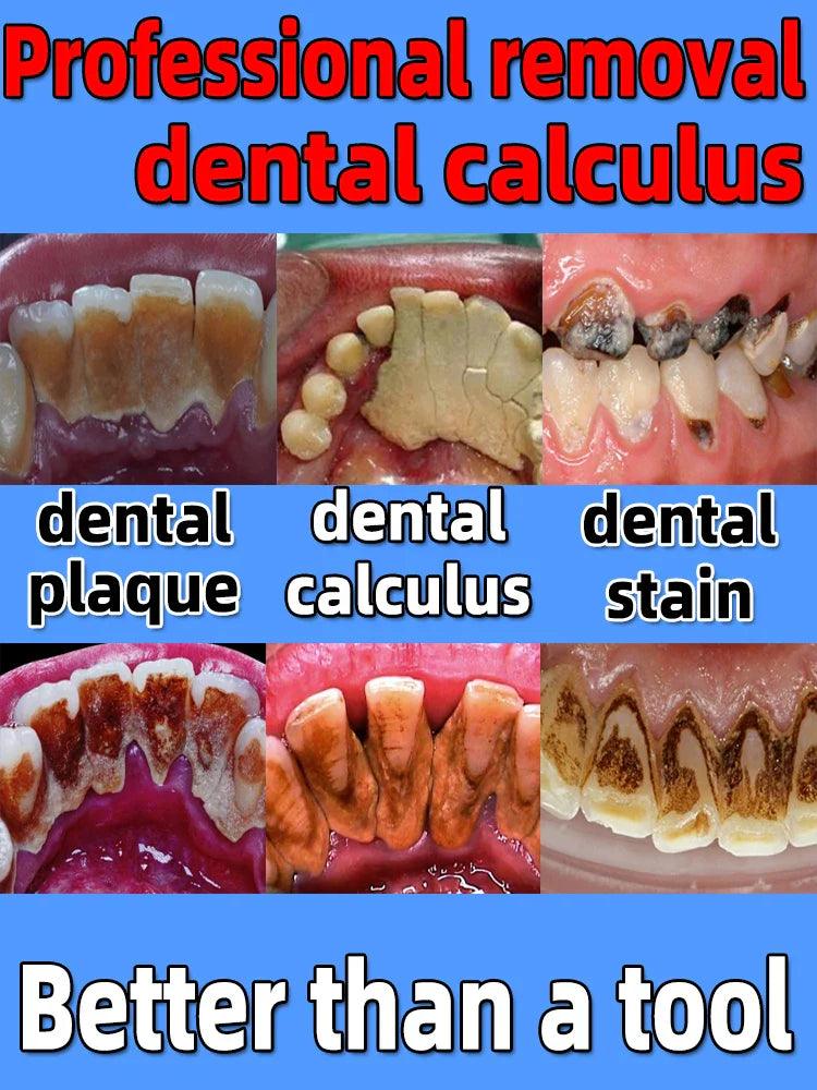 Calculus Clear Lemon Whitening Solution