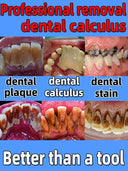 Calculus Clear Lemon Whitening Solution for Bright Teeth