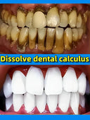 Calculus Clear Lemon Whitening Solution for Bright Teeth