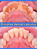 Calculus Clear Lemon Whitening Solution for Bright Teeth