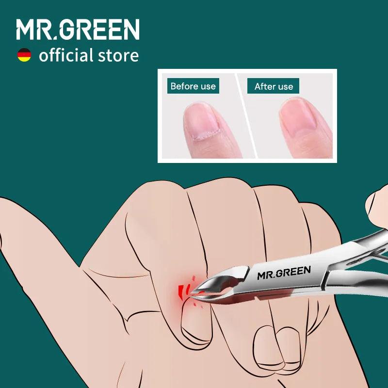 MR.GREEN Cuticle Nippers Nail Manicure Cuticle Scissors Clippers Trimmer Dead Skin Remover Pedicure Stainless Steel Cutters Tool  ourlum.com   