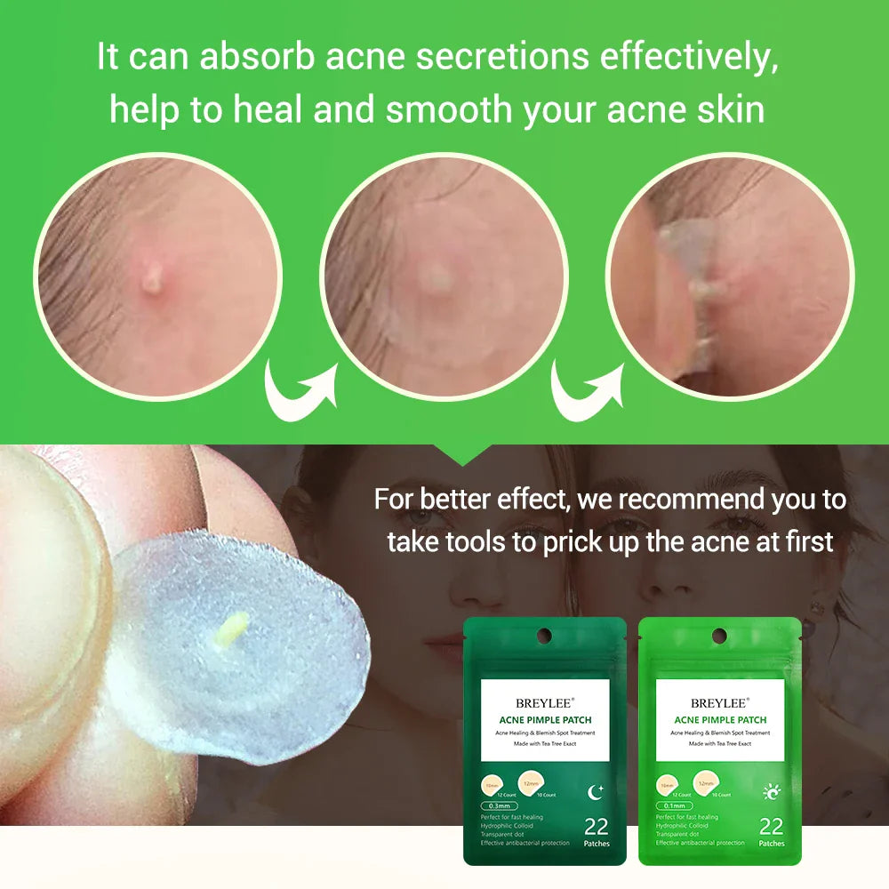 BREYLEE Acne Pimple Patch  Stickers Acne Treatment Pimple Remover Tool Blemish Spot Facial Mask Skin Care  Waterproof 22 Patches  ourlum.com   