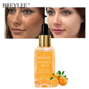 Radiant Glow Vitamin C Serum Dark Spot Brightening Solution