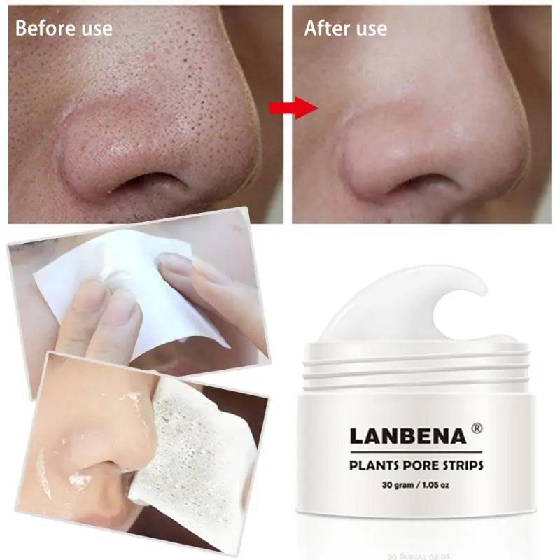 LANBENA Blackhead Eliminator Peel-Off Mask for Clear Skin