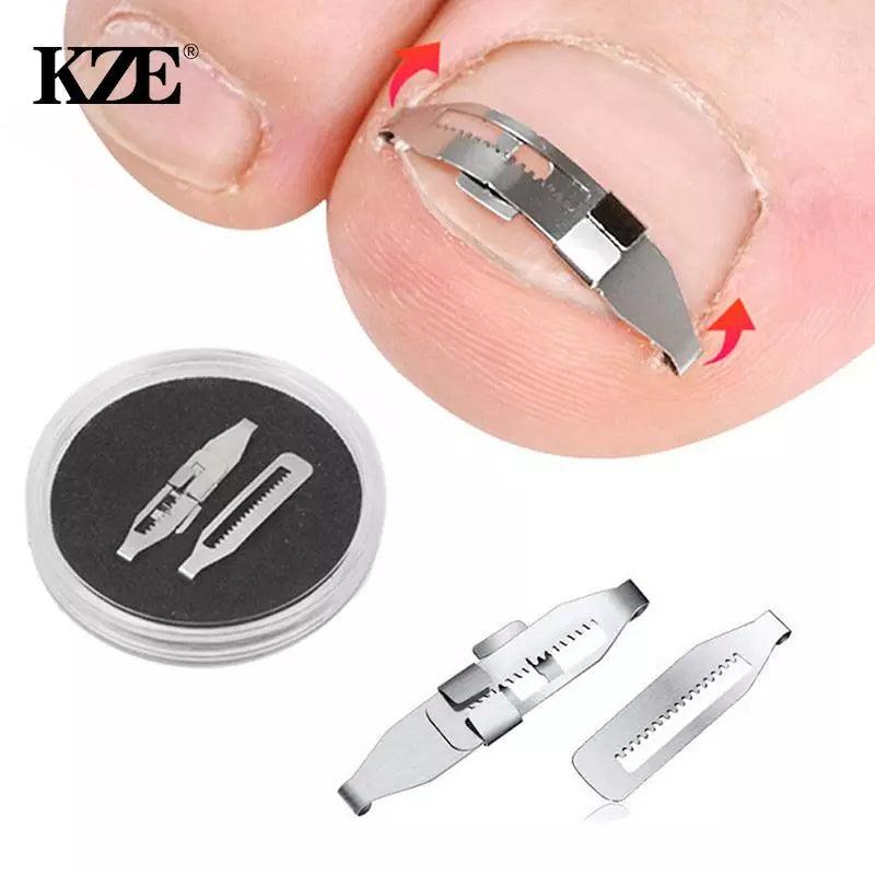 Ingrown Toenail Corrector Kit: Professional Foot Care Solution