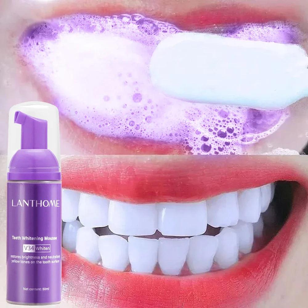 Brighter Smile Teeth Whitening Mousse: Deep Stain Removal & Fresh Breath