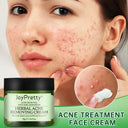 Herbal Acne Treatment Cream for Clear Skin and Pore Purification