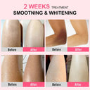 Body Cream Chicken Skin Removal Treatment Keratosis Pilaris Lotion Rough Bumpy Pore Spots Care Moisturizer Whitening Creams 60g  ourlum.com   