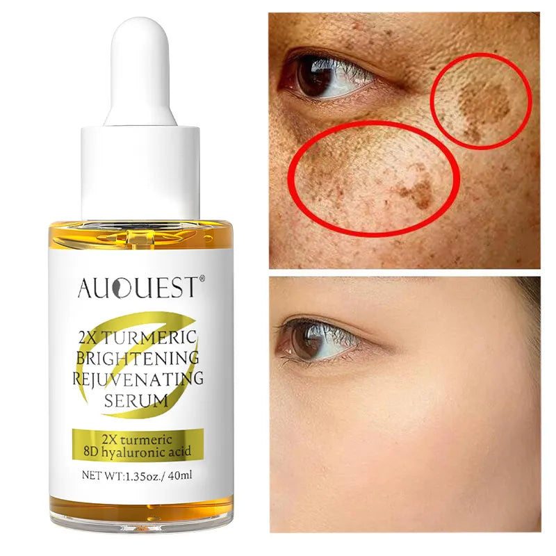 Dark Spot Serum: Turmeric & Vitamin C Brightening Solution  ourlum.com Default Title  