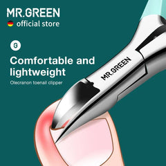 Precision Ingrown Toenail Clippers: Stainless Steel Nail Correction Tool