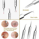 Acne Blackhead Removal Tweezers for Clear Complexion Tool