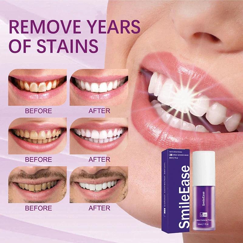 V34 Purple Whitening Toothpaste Cleans Mouth Fresh Breath Remove Yellow Stains Protect Teeth White Decontamination Care 2024  ourlum.com   