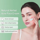 Herbal Acne Treatment Cream for Clear Skin and Pore Purification