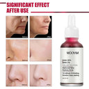 New Face Makeup Peeling Solution AHA 30% BHA 2% Serum