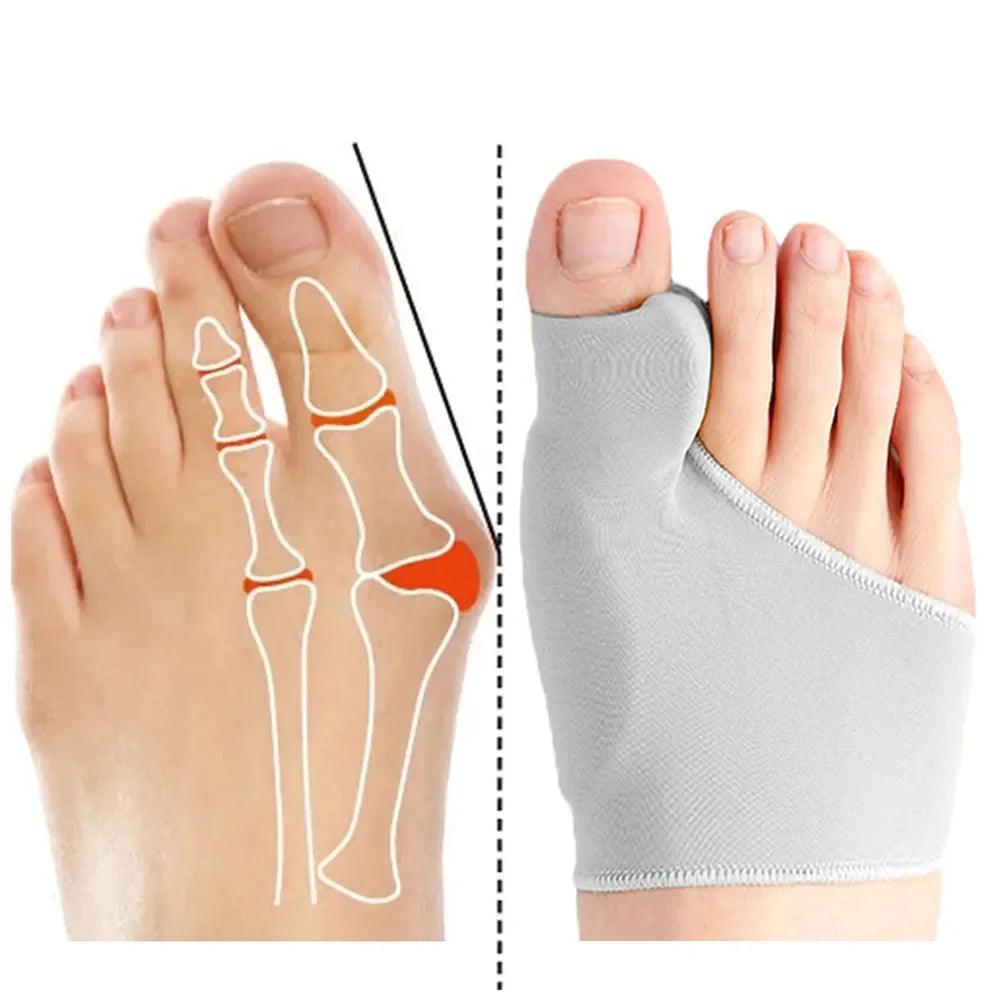 Orthotic Bunion Corrector Set: Align Toes, Comfort Fit & Support