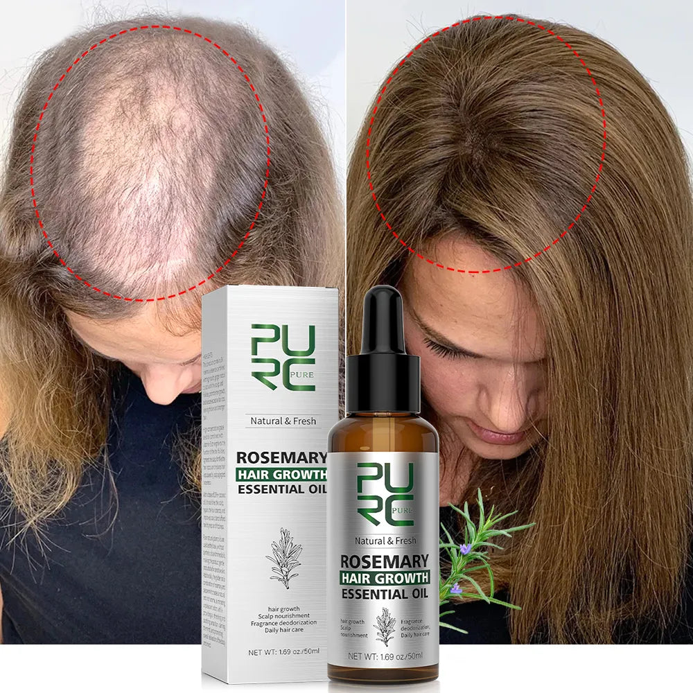 PURC Rosemary Oil Hair Growth for Men Women Fast Growing Products Essential Oils Ginger Anti Hair Loss Scalp Treatment Hair Care  ourlum.com   
