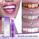 Teeth Whitening Mousse: Deep Cleaning and Stain Repair