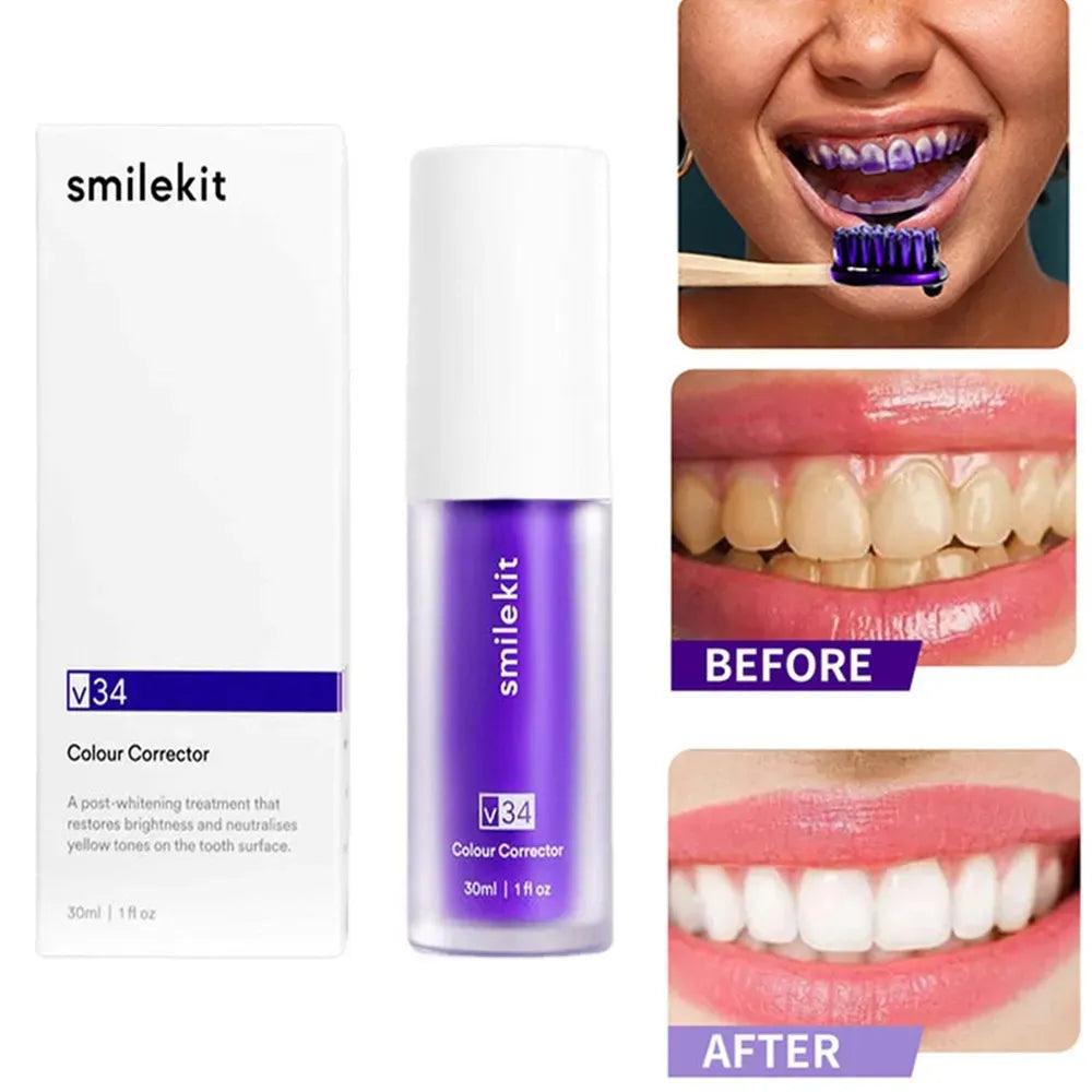 Tooth Cleansing Mousse: Advanced Stain Removal & Fresh Breath - Whiter Smile & Oral Care