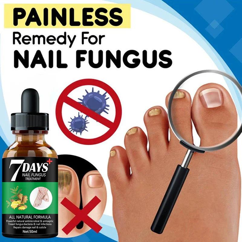 7DAYS Nail Fungus Treatment Essence Serum Care Hand and Foot Care Removal Repair Gel Anti-infective  ourlum.com   