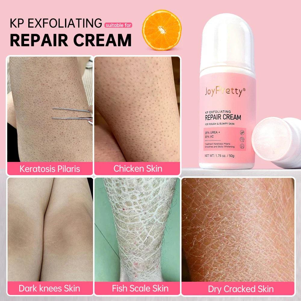 Body Cream Chicken Skin Removal Treatment Keratosis Pilaris Lotion Rough Bumpy Pore Spots Care Moisturizer Whitening Creams 60g  ourlum.com   