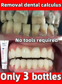 Brightest Smile Dental Care Complete Whitening Solution