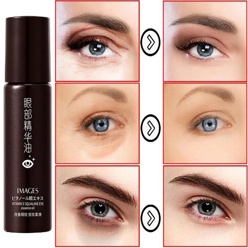 Youthful Eyes Retinol Serum: Dark Circle & Aging Solution  ourlum.com   