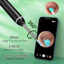 Advanced Ear Cleaning Kit with HD Camera & LED Lights