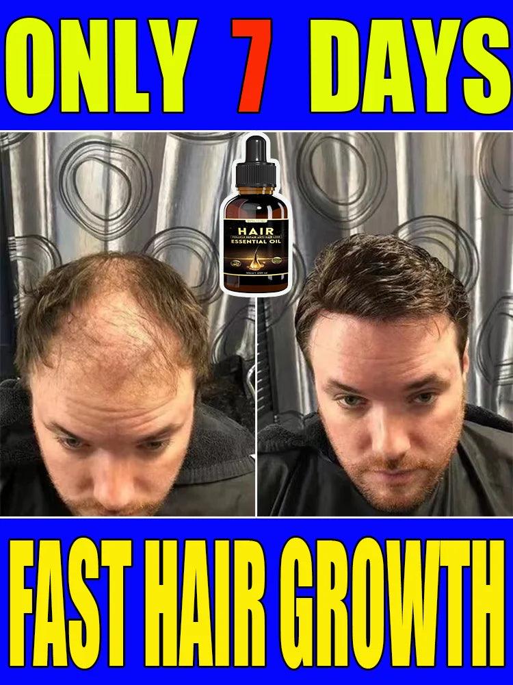 Best-selling Hair Growth Products, Anti-Hair Loss Hair Growth Serum for Men and Women, Fast Hair Growth Oil, 100% Natural  ourlum.com   