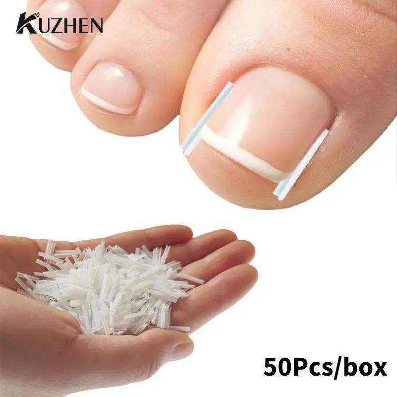 50Pcs Ingrown Toenail Correction Tool Ingrown Toe Nail Treatment Elastic Patch Sticker Straightening Clip Brace Pedicure Tool  ourlum.com   