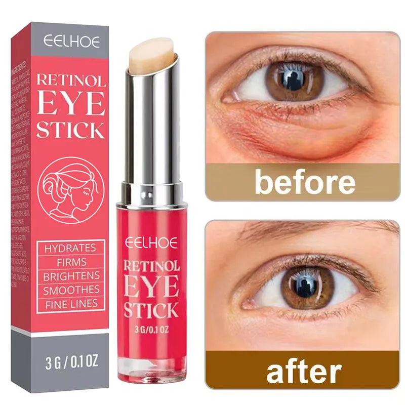 Retinol Anti-Wrinkle Eye Cream Remove Eye Bags Dark Circles Anti Aging Lifting Firming Whitening Moisturizing Brighten Skin Care  ourlum.com   