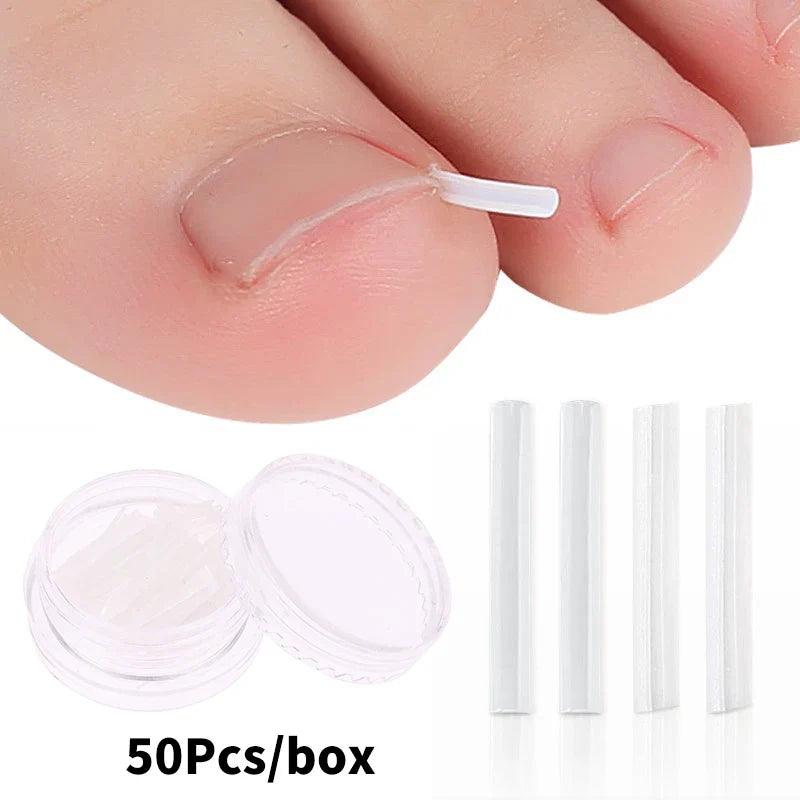 50Pcs Ingrown Toenail Correction Tool Ingrown Toe Nail Treatment Elastic Patch Sticker Straightening Clip Brace Pedicure Tool  ourlum.com   