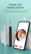 Smart Visual Ear Cleaner with Camera 1296P USB C Earpick