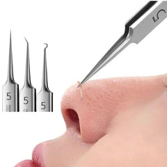 Blackhead Removal Kit: Ultimate Acne Treatment for Clear Pores & Skin