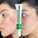 Acne Control Cream: Herbal Whitening and Moisturizing Solution