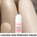 Body Cream Chicken Skin Removal Treatment Keratosis Pilaris Lotion Rough Bumpy Pore Spots Care Moisturizer Whitening Creams 60g  ourlum.com United State  