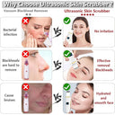 Ultrasonic Skin Scrubber Remover Blackhead Ultrasonic Peeling Facial Scrubber Shovel Deep Cleaning Face Lifting Remove Pore Acne  ourlum.com   