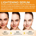 Vitamin C Brightening Serum: Dark Spot Remover & Anti-Aging Solution  ourlum.com   