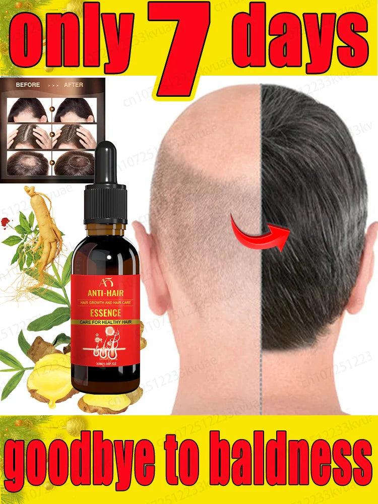 Rapid hair growth essential oil, repair baldness  ourlum.com   