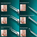 Acne Blemish Remover Tool for Flawless Skin Clarity