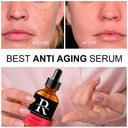 Youthful Radiance Skin Serum: Diminish Wrinkles Hydrate