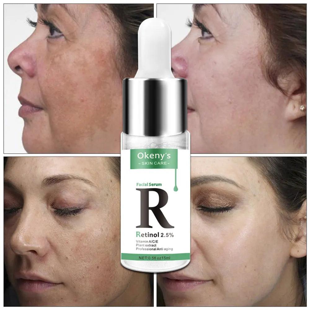 Radiant Skin Renewal Serum with Retinol & Vitamin C - Anti Wrinkle, Dark Spot Corrector, Collagen Booster  ourlum.com   