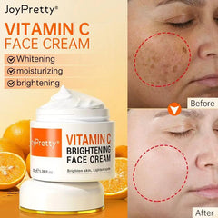 Vitamin C Brightening Face Cream: Dark Spots Removal & Skin Whitening