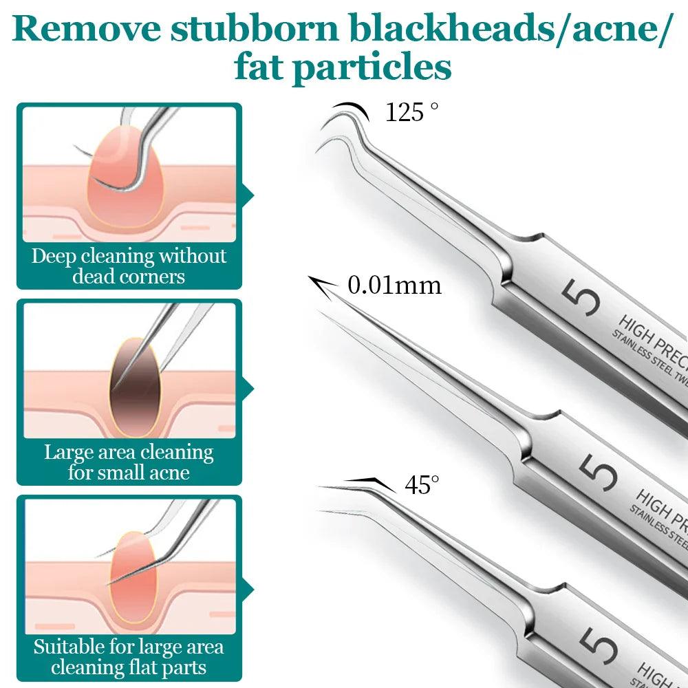 5/8PCS Acne Blackhead Removal Needles Black Dots Cleaner Black Head Pore Cleaner Deep Cleansing Tool Beauty Face Skin Care Tool  ourlum.com   