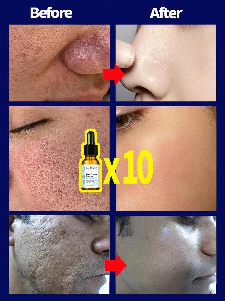 Pore Shrinking Serum Face Removing Large Pores Tightening Repairing Facial Pore Minimizing Essence Skin Care Beauty  ourlum.com   