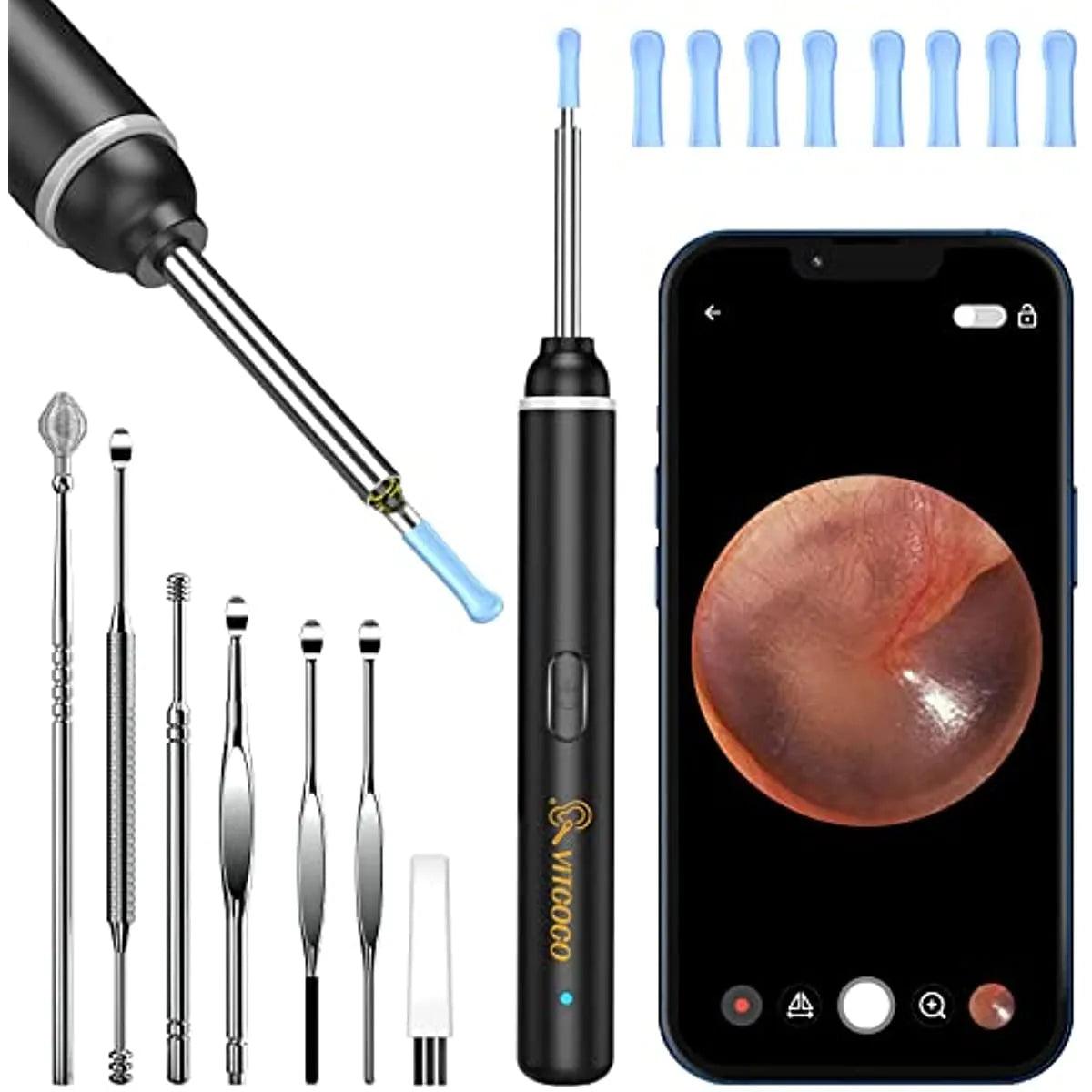 Advanced Ear Cleaning Kit with HD Camera & LED Lights for Smart Devices