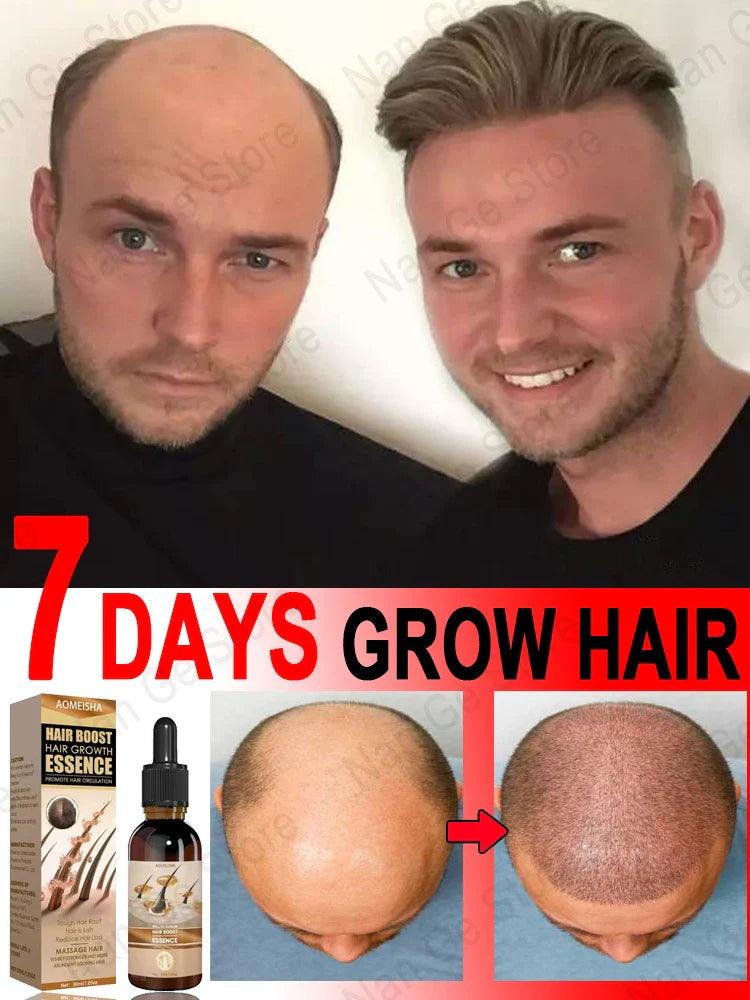 Unisex Hair Growth Oil Hair Loss Treatment Rapid Hair Growth Effective Baldness Repair Hereditary Postpartum Hair Loss  ourlum.com   